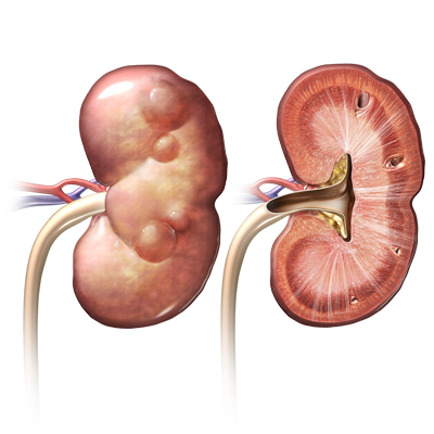 kronik-yetmezlik, kidney