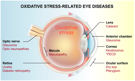 oxidative stress in eye diseases